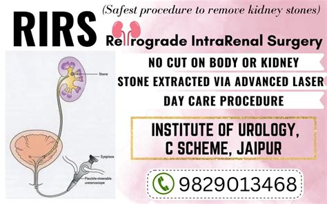 RIRS Surgery - Kidney Stone Laser Surgery at Institute of Urology, Jaipur