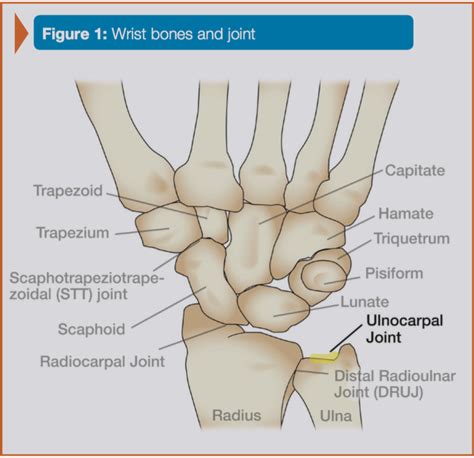 Open Release of the Ulnar Nerve at the Wrist (Nerve Injuries, Ulnar Sided Wrist Pain) | Lonestar ...