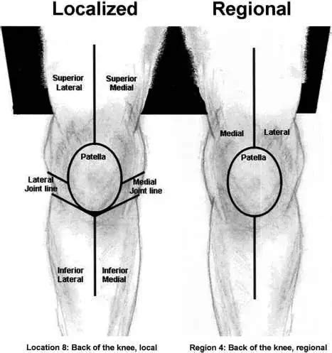 Knee diagram | Healthiack