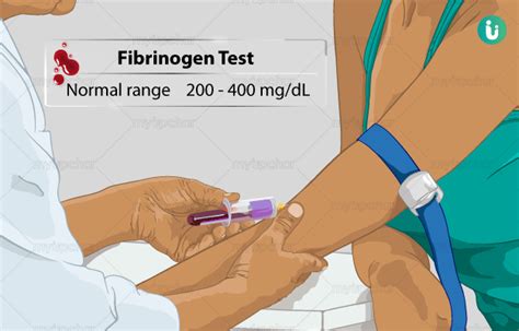 Fibrinogen: Procedure, Purpose, Results, Normal range, Cost, Price, Online booking