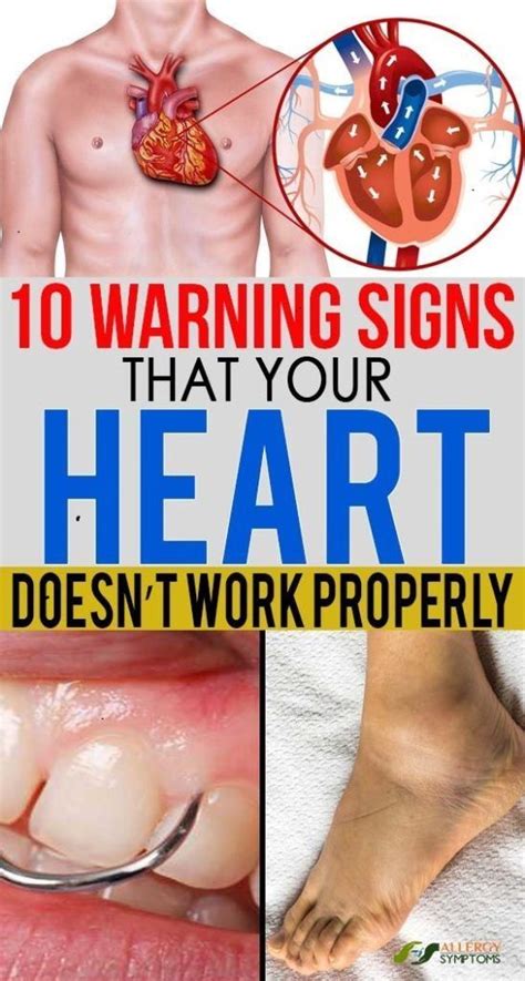 10 Warning Signs That Your Heart Doesn’t Work Properly | Warning signs, Heart disease symptoms ...