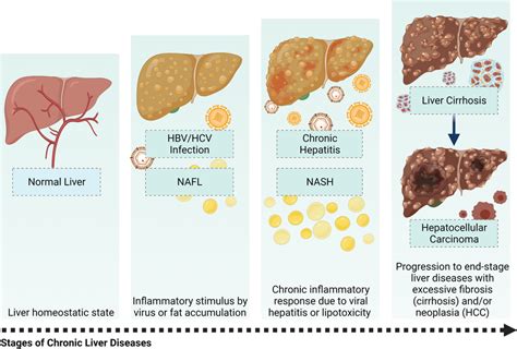 Clinicopathological stages of chronic liver diseases. The liver in its ...