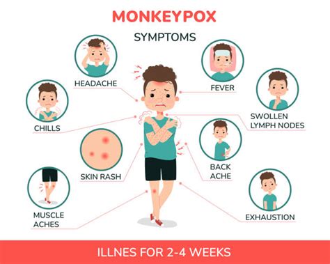 Mpox Symptoms in Children: A Parent’s Guide to Early Detection