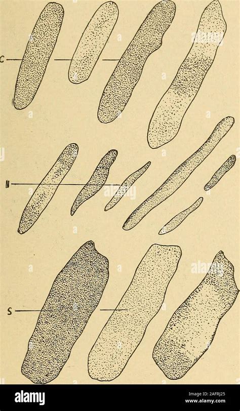 . Urinary analysis and diagnosis by microscopical and chemical examination. Fig. 67.—Blood Casts ...