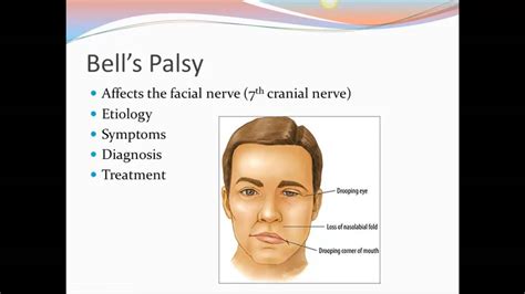 Nervous System Diseases - YouTube