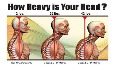 Your Neck Pain: how to know if it is it due to Aging or Posture?