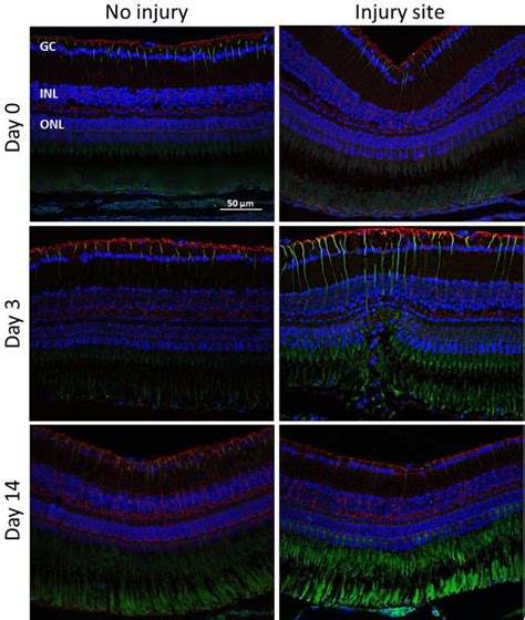 Müller Glia Cell Activation in a Laser-induced Retinal Degeneration and ...