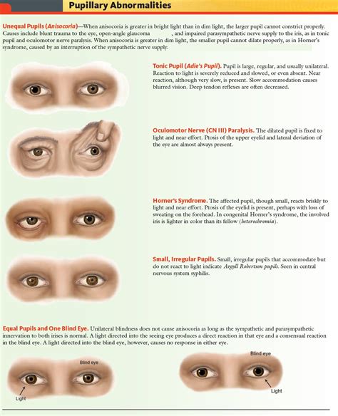 อันดับหนึ่ง 103+ ภาพ ขนาด Pupil ปกติ ใหม่ที่สุด