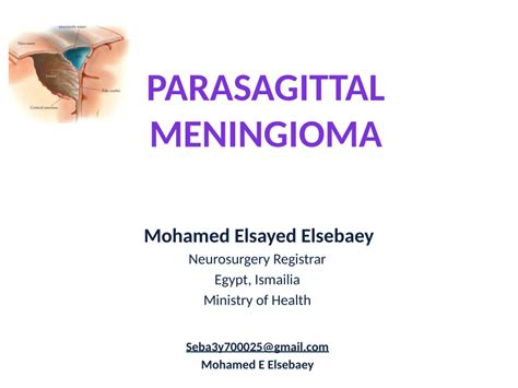 (PDF) parasagittal meningioma