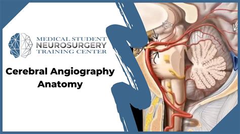 Cerebral Angiography Anatomy - YouTube