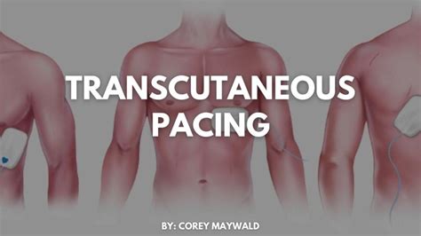 Transcutaneous Pacing - Code One CPR Training