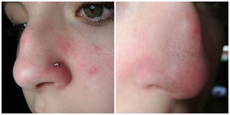 Kennyista: Purederm Nose Pore Strips Review