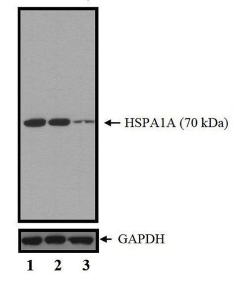 HSP70 Monoclonal Antibody (W27) (MA1-90504)