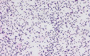 Streptococcus mutans