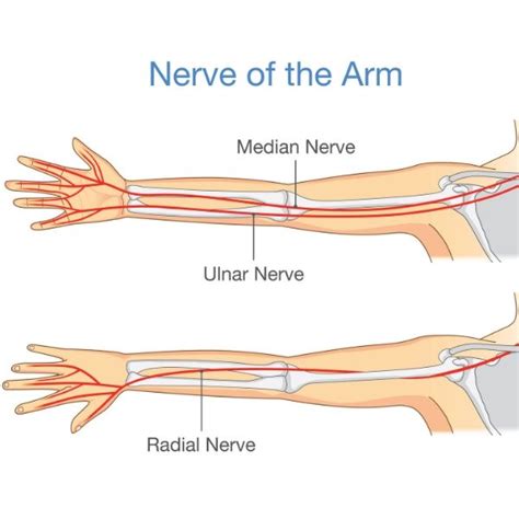 Uncommon Nerve Compression Syndromes | Elbow Specialist | South Windsor, Enfield, Glastonbury CT