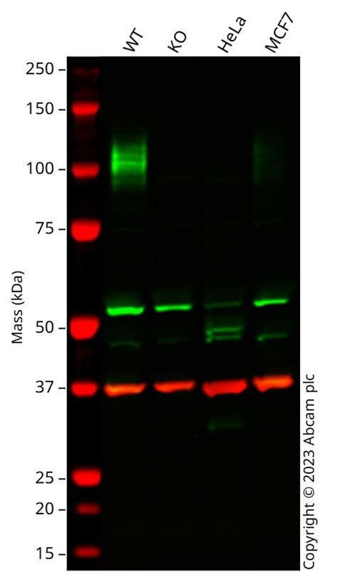 Recombinant Anti-LAMP1 antibody [EPR4204] - Lysosome Marker KO Tested (ab108597)