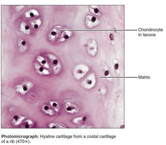 Cartilage SAC - SCIENTIST CINDY