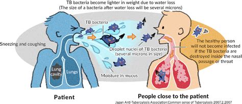 Tuberculosis transmission routes and unexpected sources of infection ...