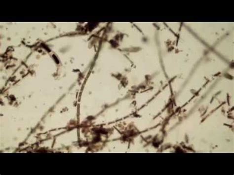 Pond Water Microorganisms - YouTube