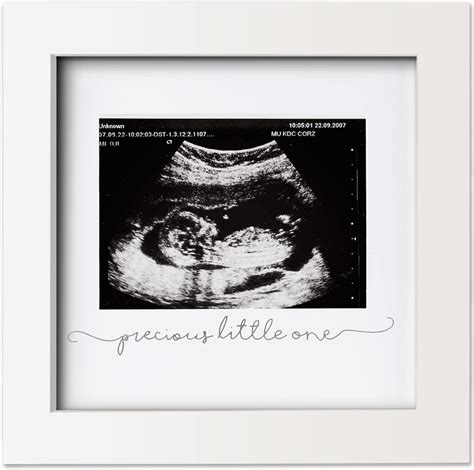 Amazon.com: Baby Sonogram Picture Frame - Modern Ultrasound Frame for ...