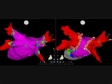 Ascension Seton Williamson expands cardiac program | Round Rock, TX Patch