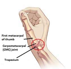 CMC Joint - Active650