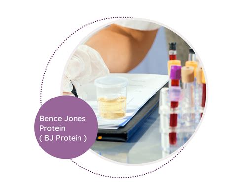 Bence Jones Protein (BJ Protein) - MediScan Lab