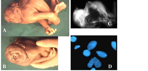 Lethal Developmental Defects: An Overview