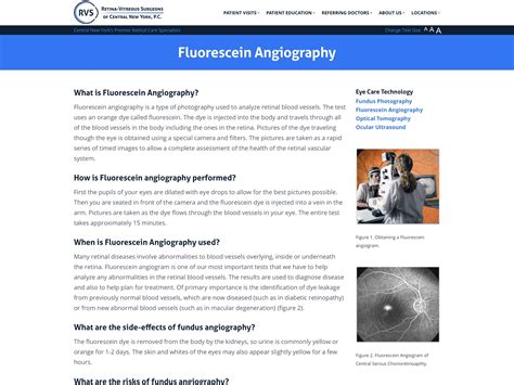 Fluorescein Angiography - Retina-Vitreous Surgeons of CNY