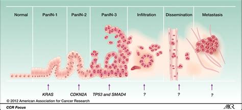 Pre-cancerous lesions (Overview) - THE OLIVE LABORATORY