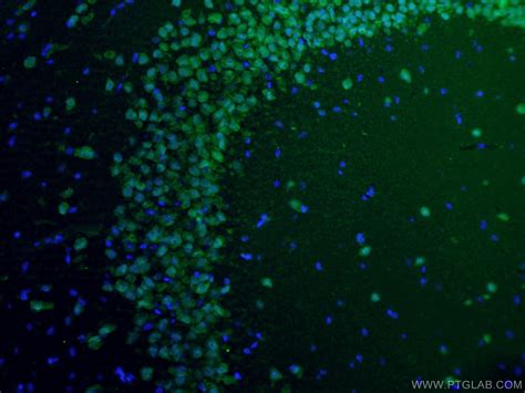 NeuN Antibody 26975-1-AP | Proteintech