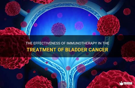 The Effectiveness Of Immunotherapy In The Treatment Of Bladder Cancer ...