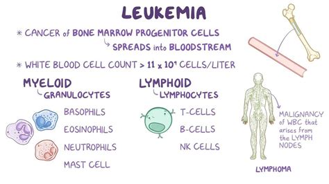 Hairy Cell Leukemia Symptoms