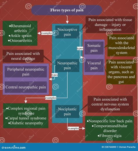 Pain has three basic types stock illustration. Illustration of pain ...