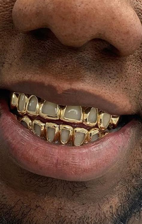 10K Solid Gold 8 Top & 8 Bottom - Gold Teeth Master