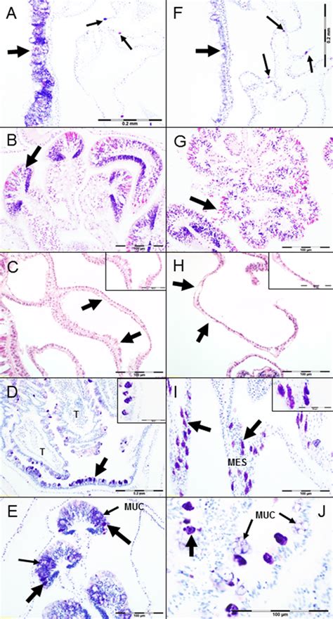 Histology observations. (A) Coenenchyme epidermis from apparently ...