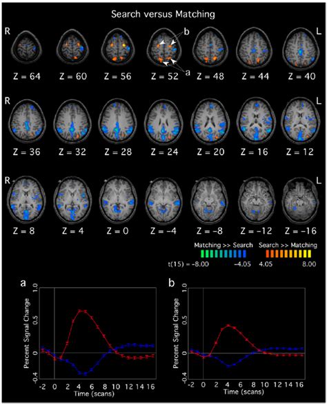 Functional maps demonstrating regions that were more active during the ...