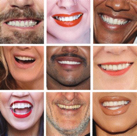 How the American Celebrity Smile Became a Global Export | Allure