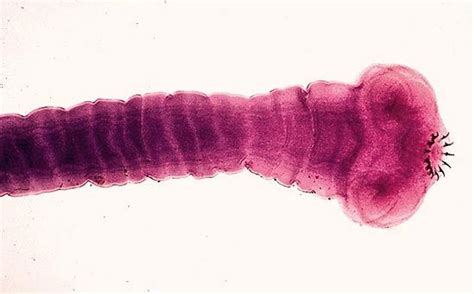 Pork tapeworm | flatworm | Britannica