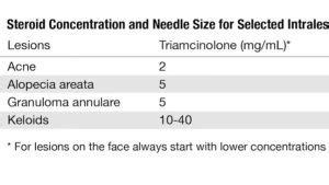 Kenalog injection