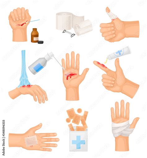 Hands with Injured Skin and Procedures of Bandaging and Wound Cleaning ...