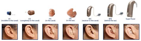 Common Types and Styles of Hearing Aids - Perfect Hearing