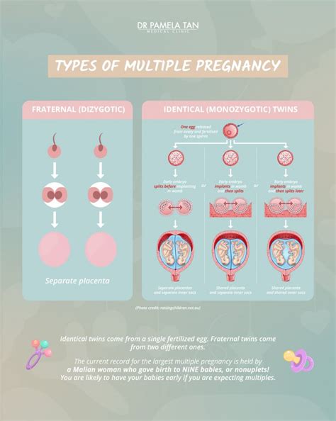 Twin Pregnancy 101: Things To Learn When Expecting Multiples