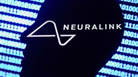 Elon Musk’s Neuralink Could Be Trialed In Humans In 2023. Here’s What You Need To Know