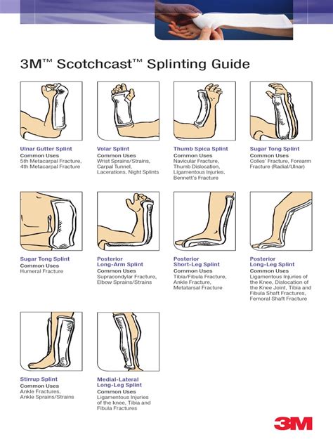 BA82 Scotchcast Splinting Pocket Guide v1 3 Final