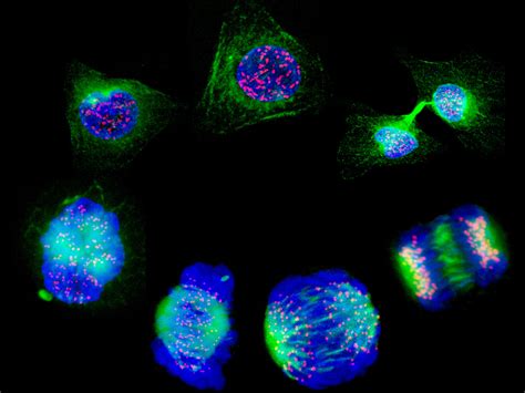 Human cells showing the stages of cell division | Wellcome Collection