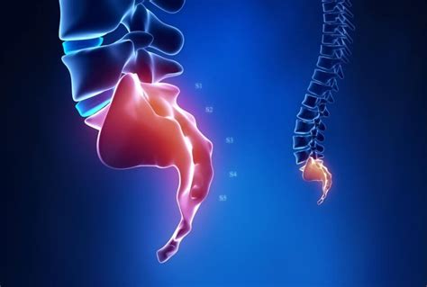 Treatment Coccyx pain | Spine and Orthopedic Specialists: NEO Surgical Group