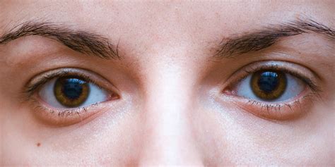 8 Causes of Tired Eyes That Have Nothing to Do With Sleep—and What You Can Do | SELF