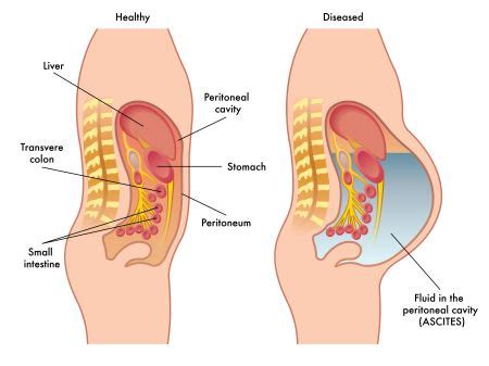 Mesentery vs. Peritoneum | Definition, Structure & Functions | Study.com