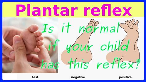 plantar reflex - YouTube